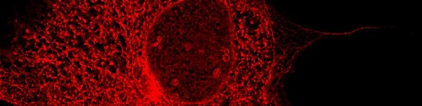 Avancée majeure dans la compréhension des dynamiques des membranes internes d’une cellule animale