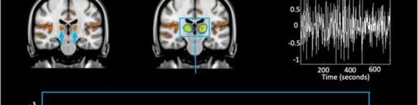 La lumière module la connectivité thalamo-corticale en fonction de la tâche pendant une tâche d'attention auditive